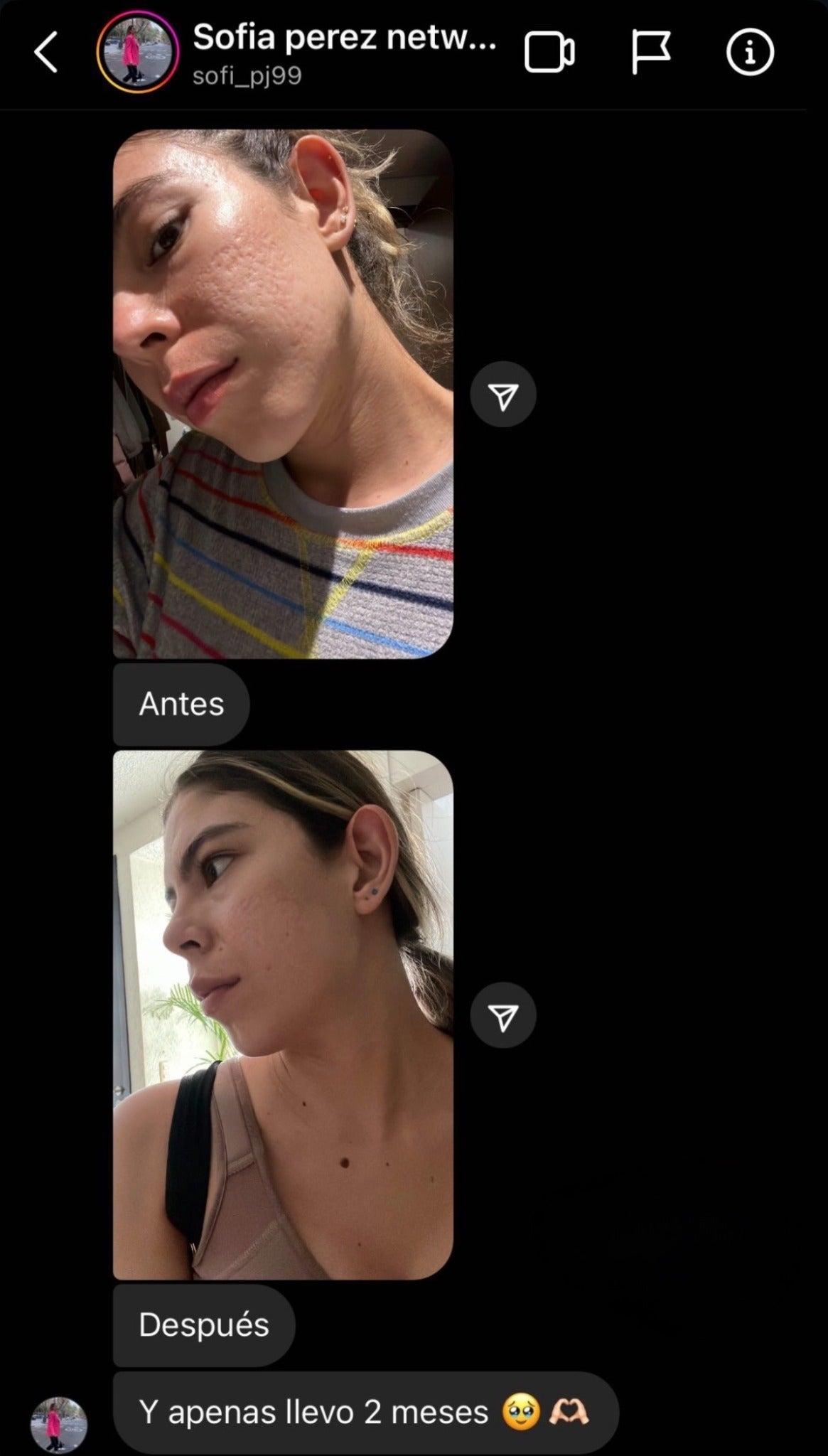 Antes y después compartido por Sofía después de dos meses