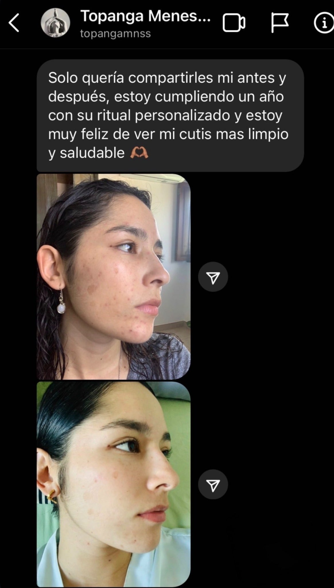 Antes y después de Topanga tras un año con su ritual personalizado