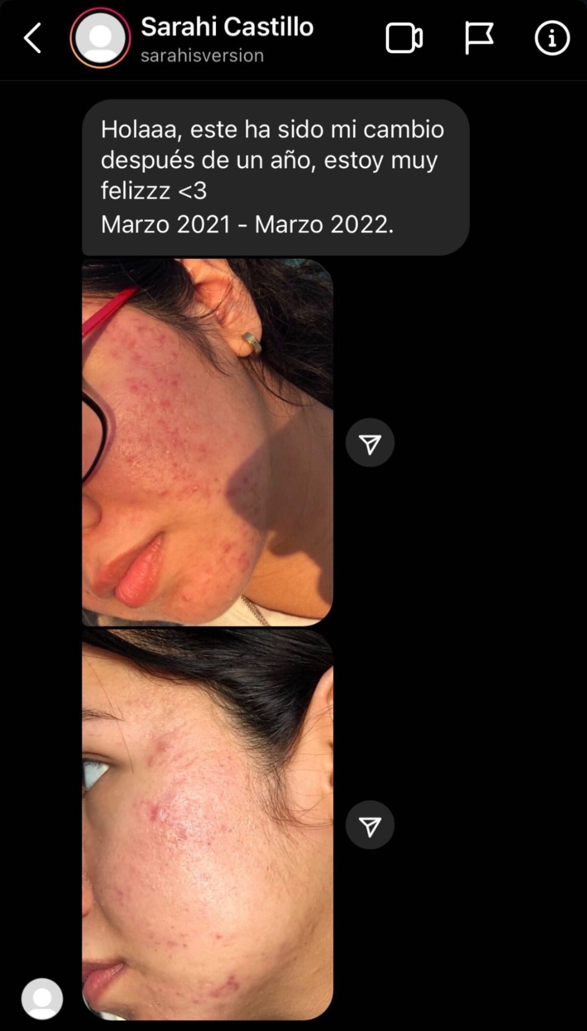 Experiencia de Sarahi Castillo después de un año de uso