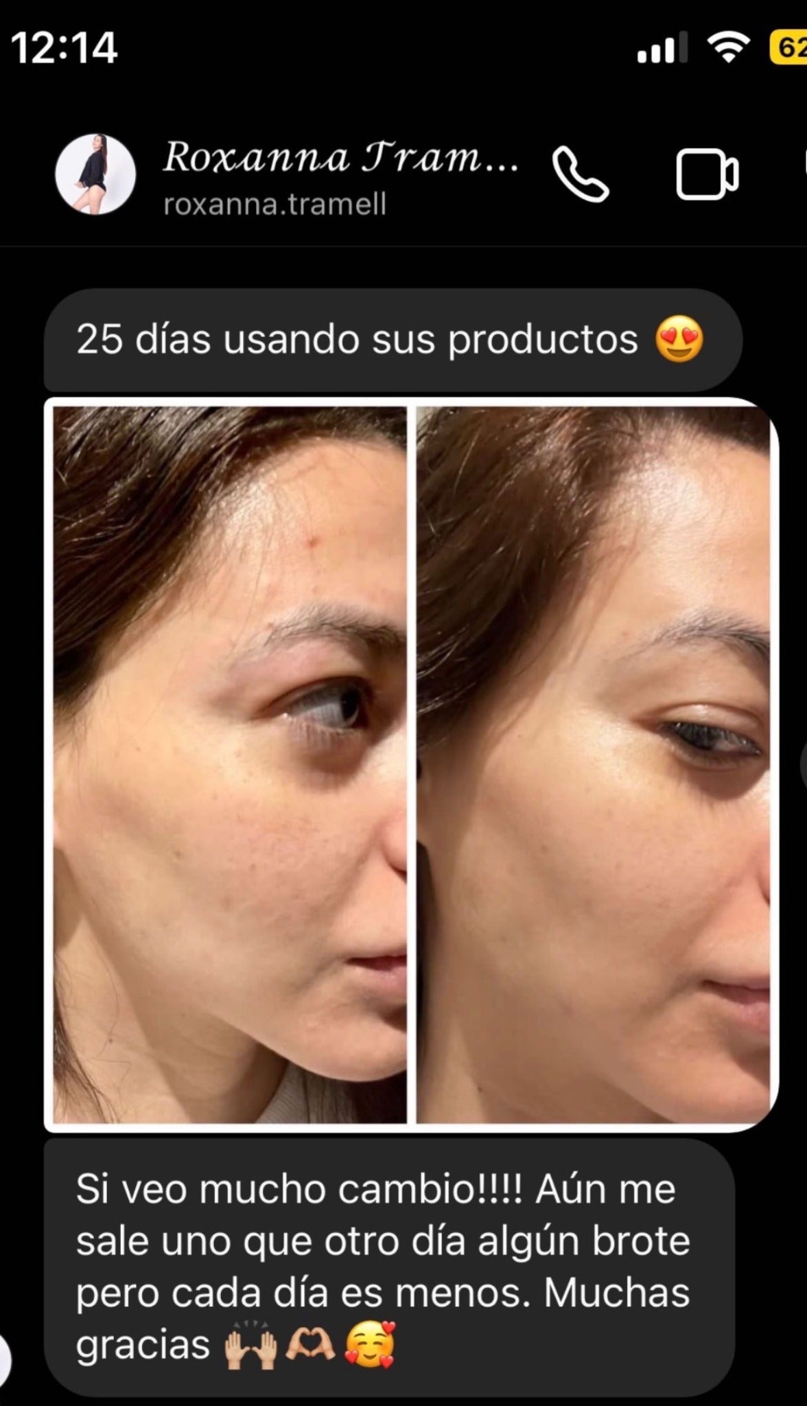 Comparación de Roxanna después de veinticinco días de uso