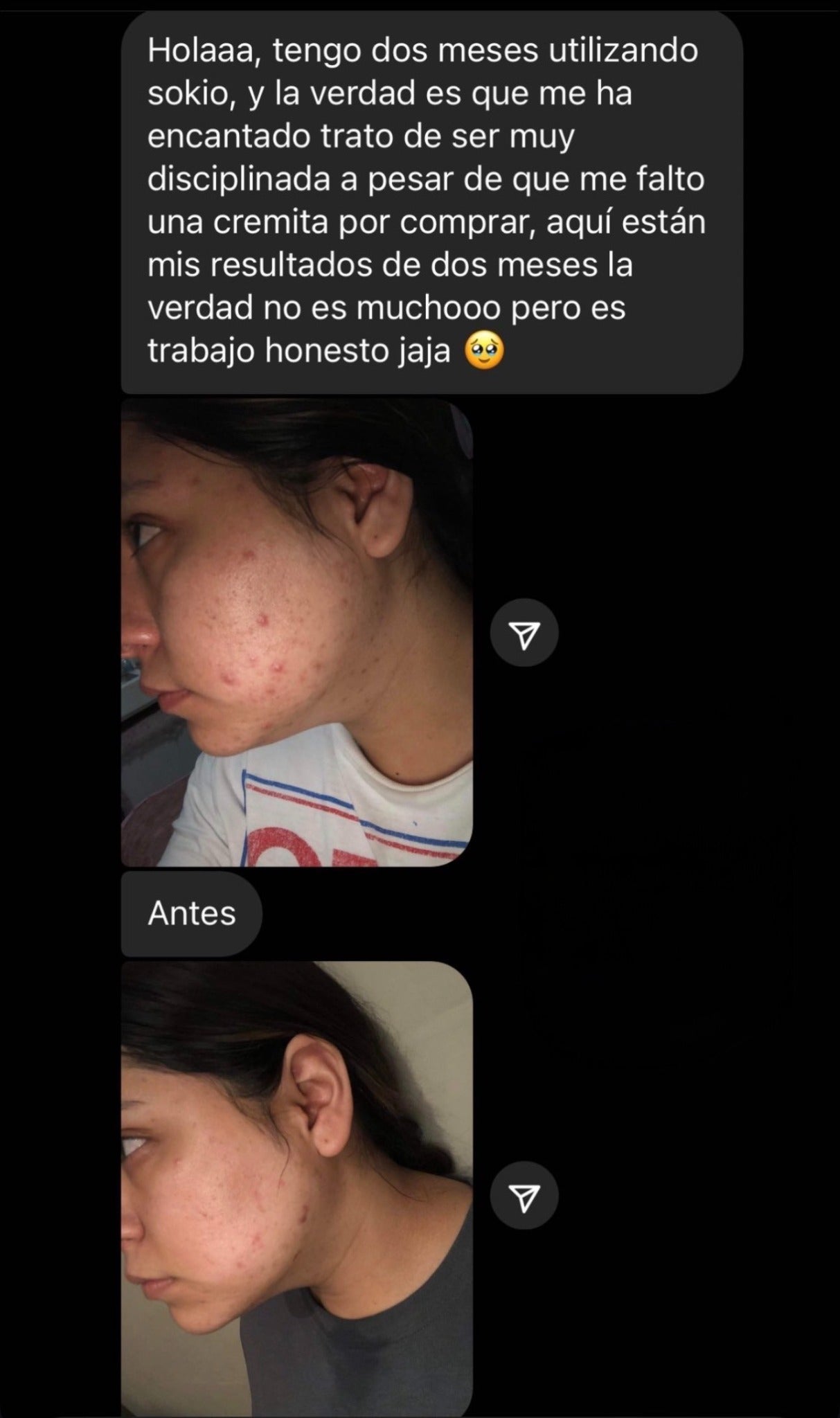Mensaje y fotografías de una cliente después de dos meses con Sokio